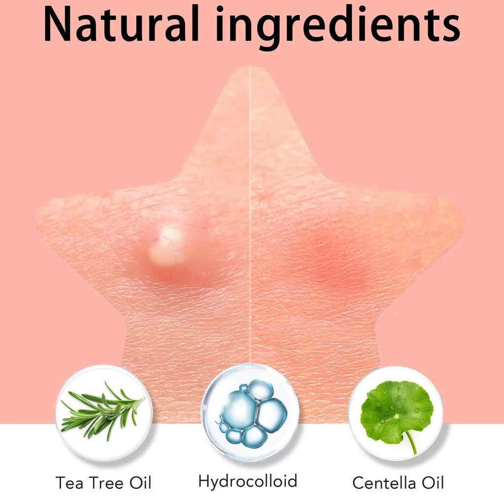 1008/504 Pieces/Box of Pimple Patches, Non Irritating Acne Stickers, High-Quality Salicylic Acid and Tea Tree Oil Acne Patches